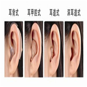 【大连助听器总部】春节不休！0411-84338707 