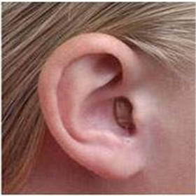 大连春柳河助听器【聆听美好******】   0411-86713343