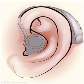 【大连助听器总部】属于您的美好声音！0411-84338707 