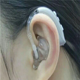 【大连助听器总部】9月12-13美国斯达克优惠进行中0411-84338707