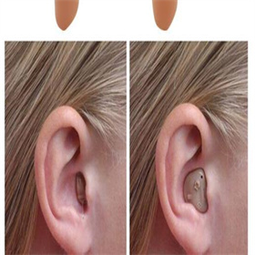 【大连助听器总部】本月13-14日美国斯达克助听器大促0411-84338707  