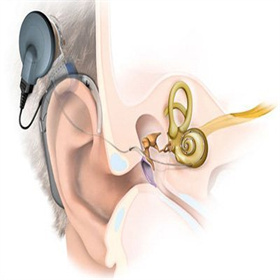 【大连助听器马栏老店】戴上助听器我们帮您重拾生活的细腻0411-84210003  